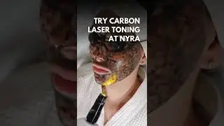 Glow Like Never Before with Carbon Laser Toning! #dermatologist