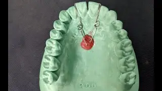 Finger Spring Fabrication | Removable Orthodontic Appliance | Orthodontics