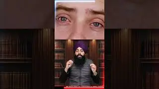 Sleeping with Eyes Open 😴👀  Strange Sleep Habits Explained #SleepHabits #EyesOpenSleep #StrangeSleep