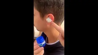 Apply Vicks VapoRub to these areas and see what happens! 😱
