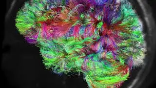 Brain Man (A-Man Remix)