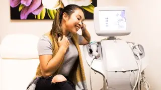 My Experience with ThermaLift (mini facelift!)