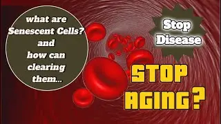 What Are Senescent Cells? How Can Clearing Them From Your Body Stop Disease and The Aging Process?