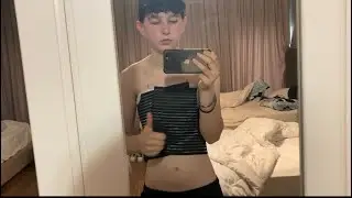 Top surgery in Turkey part 1 | @transgendersurgerybyneda