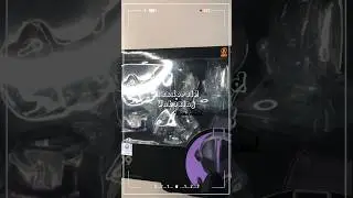 Nendoroid Unboxing Bondrewd from Made in Abyss Anime