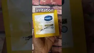 Vaseline Total Moisture Bar Soap: The Ultimate Skin Hydration Solution #vaseline #dryskinsolution