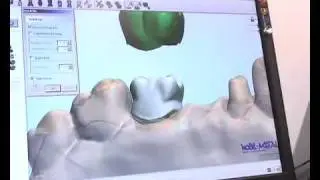 Nobil Metal in Expodental 2009