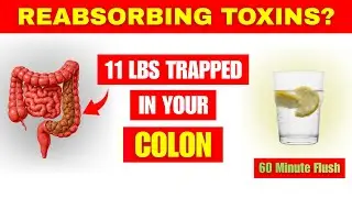 5 KG of STOOL Out in 1 Hour! No More Constipation, No Fatigue! Flat Belly! Senior Health Tips