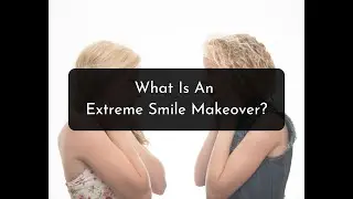 Extreme Smile Makeover Overview