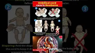 Umbilical Cord Care for Newborns | Easy Tips Every Parent Must Know