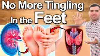 Eliminate Feet Tingling (Tanmil) in 3 Steps - Fix Numbness and Heaviness