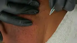 Tweezing Short Hairs (Full Length)