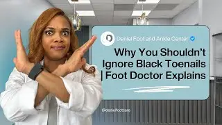 Black Toenails Are NOT Normal &ndash; What It Really Means!