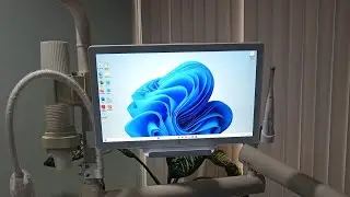 INTRA ORAL CAMERA 😍