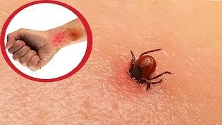 LES 10 INSECTES LES PLUS VENIMEUX DU MONDE | Eureka