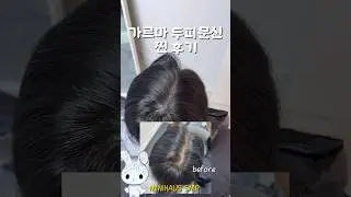 MINIHAUS SMP&bull;두피문신&bull;숱채움&bull;헤어라인&bull;흉터커버🖤韩国SMP🇰🇷头皮纹绣&bull;MINIHAUS SMP(SMP = Scalp Micro Pigmentation)