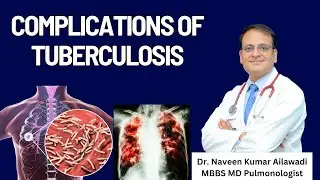 Complications of Tuberculosis | Tuberculosis - causes, symptoms, diagnosis, treatment, pathology