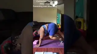 Connective tissue integration