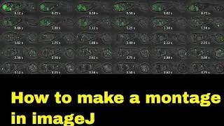How to make a montage in imageJ | automatic alignment of microscope images| Align images in ImageJ