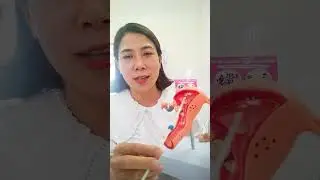Đặt v&ograve;ng tr&aacute;nh thai TCu 380A- Nữ hộ sinh Phạm Thời