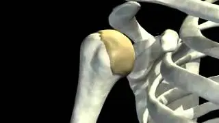 Вывих плечевого сустава