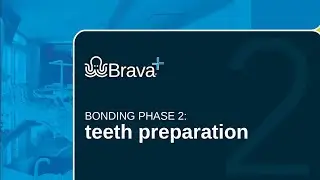 Brava Bonding 2:  Teeth Preparation