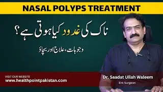 Nasal Polyps Treatment In Urdu | Nasal Polyps Kya Hota Hai | Dr. Saadat Ullah Waleem