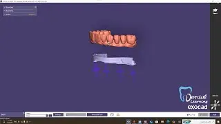 تصميم ibar باستخدام ال Exocad partial