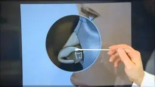 Dr. Jennifer Levine, Best Nose Surgeon in New York explains the Nasal Anatomy