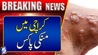 karachi me monkey pox k cases report | Channel5NewsHD