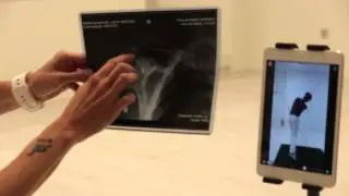 Magna Clinic, pioneros en Hipertermia Oncol&oacute;gica
