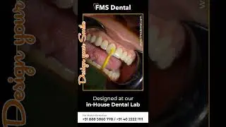 FMS Dental | Best Cosmetic Dental Clinic in Hyderabad | Smile Correction