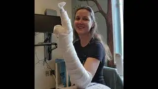 Radial Gutter Splint