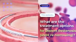 What are the treatment options for Instent Restenosis (stent re-narrowing)?