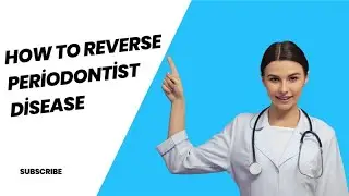 Как вылечить пародонтит