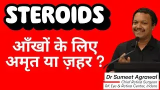 STEROIDS आँखों के लिए ज़हर हैं या दवा? 😱👁️ | Doctor Explains Truth