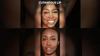 Did SZA have Fake Freckles?