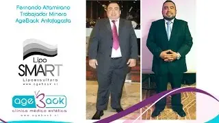 Tratamiento LipoSMART para hombres.
