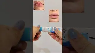 Chaptex lip balm review #lipbalm #dermatologistrecommended #lipcare #lipcareroutine #skincare #lips