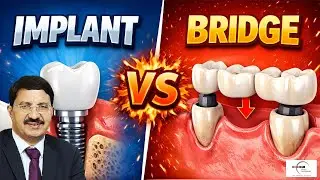 Dental Implant cost (kya vakai costly hote hain?)Dental implants are generally considered expensive