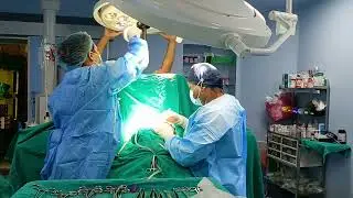 किन स्तन क्यान्सरमा Breast-Conserving Surgery (BCS) रोज्ने?