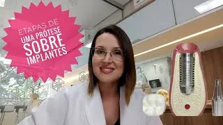 ETAPAS DE UMA PRÓTESE SOBRE IMPLANTES - DRA DANIELLE SALES