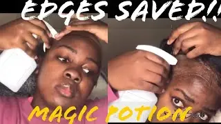 Removing Esha glue in less than 5 minutes | edges are safe and sound😂