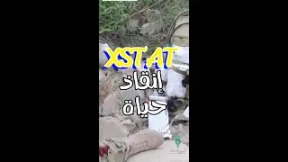 إنقاذ حياة بتقنية حديثة #XSTAT #حلول #l3oloum