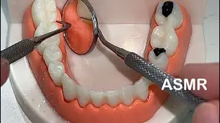 АСМР / СТОМАТОЛОГ 🦷 Чистка и лечение зубов 🪥