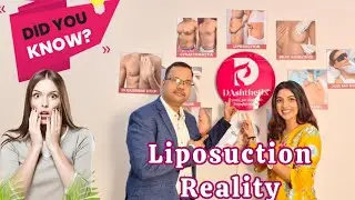 Liposuction Reality EXPLAINED | ?#liposuction#fatremoval#bodycontouring#cosmeticsurgery