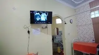 USG ADEK