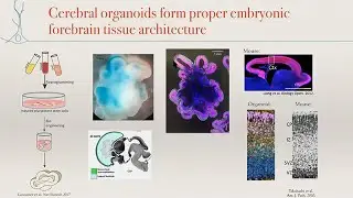 Modeling Human Brain Structure and Function Using Cerebral Organoids with Madeline Lancaster