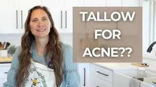 Tallow skincare for acne prone skin