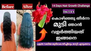 🔥മുടികൊഴിച്ചിൽ മാറി മുടി തഴച്ചു വളരാൻ ഇനി വേറൊന്നും തപ്പി പോകണ്ട | 14 days hair growth challenge